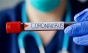 1.295 de cazuri noi de coronavirus. Număr uriaș de decese în ultimele 24 de ore