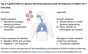 Informație revoluționara: Asimptomaticii ar fi imuni genetic la Covid-19!