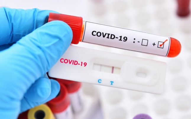 Testele rapide antigen pentru COVID-19 sunt recunoscute international si vor fi utilizate masiv