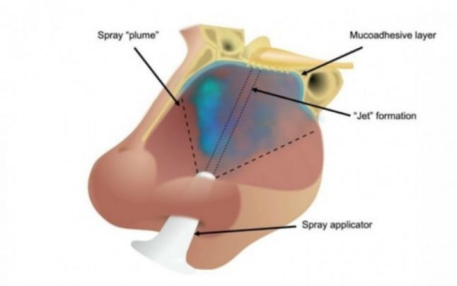 Un spray nazal care protejează împotriva noului coronavirus a fost inventat de cercetătorii din Birmingham